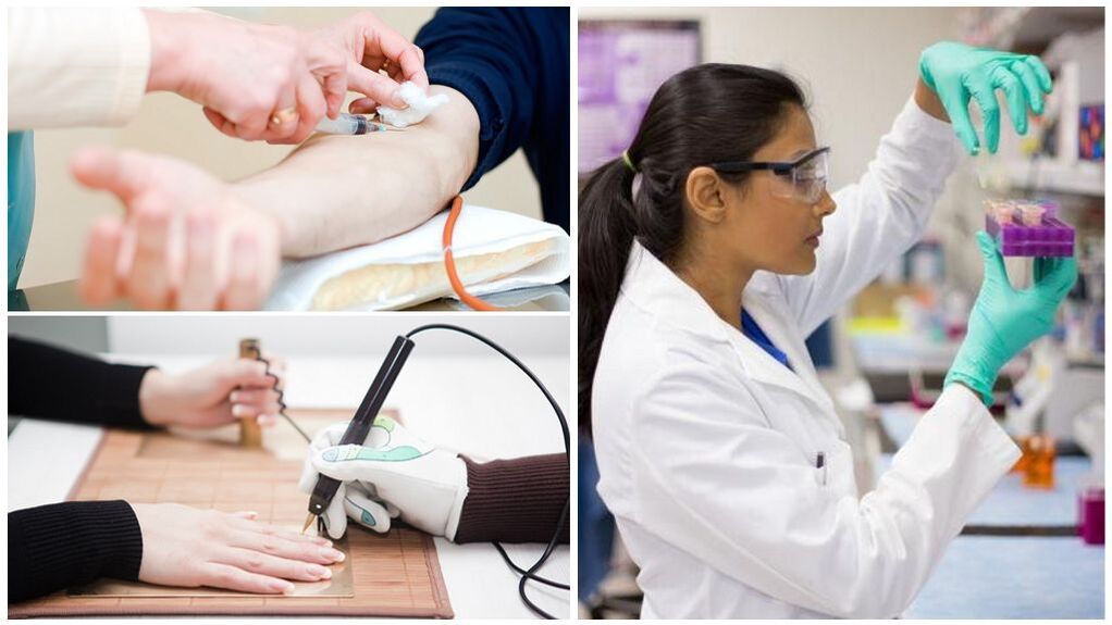 Dijagnostičke metode za otkrivanje parazita u tijelu