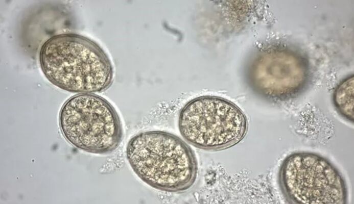 parazita pod mikroskopom