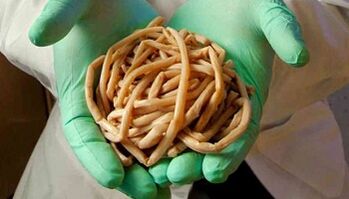 Metode uklanjanja parazita iz tijela
